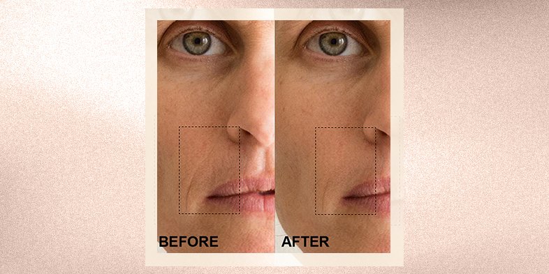 BMAG InArticle 1 Should You Apply Retinol Before Or After Moisturizer